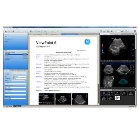 Systemy archiwizacji w położnictwie i ginekologii GE Healthcare ViewPoint