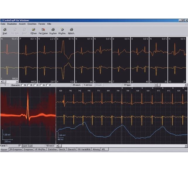 Systemy holterowskie EKG GE Healthcare CardioDay