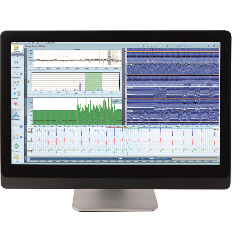 Systemy holterowskie EKG SCHILLER medilog DARWIN2