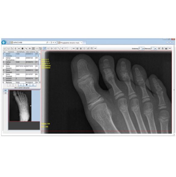 Systemy teleradiologii Synektik ArPACS WEB