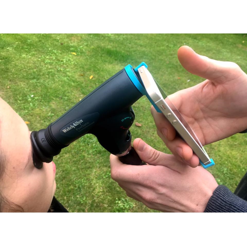 Uchwyty smartfonów do oftalmoskopów b/d iGrip