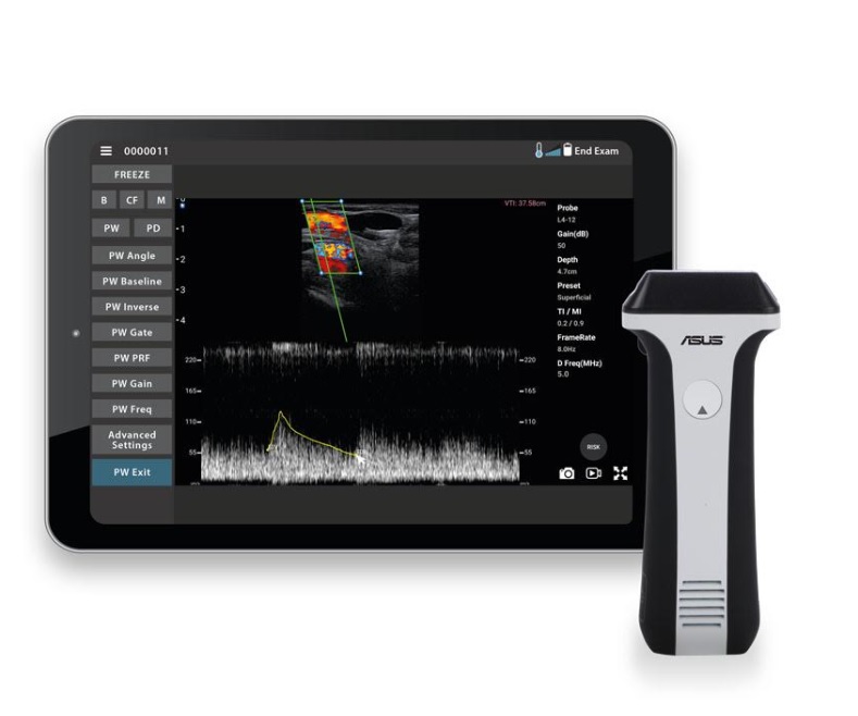 Ultrasonografy kieszonkowe ręczne (USG) ASUS LU700L