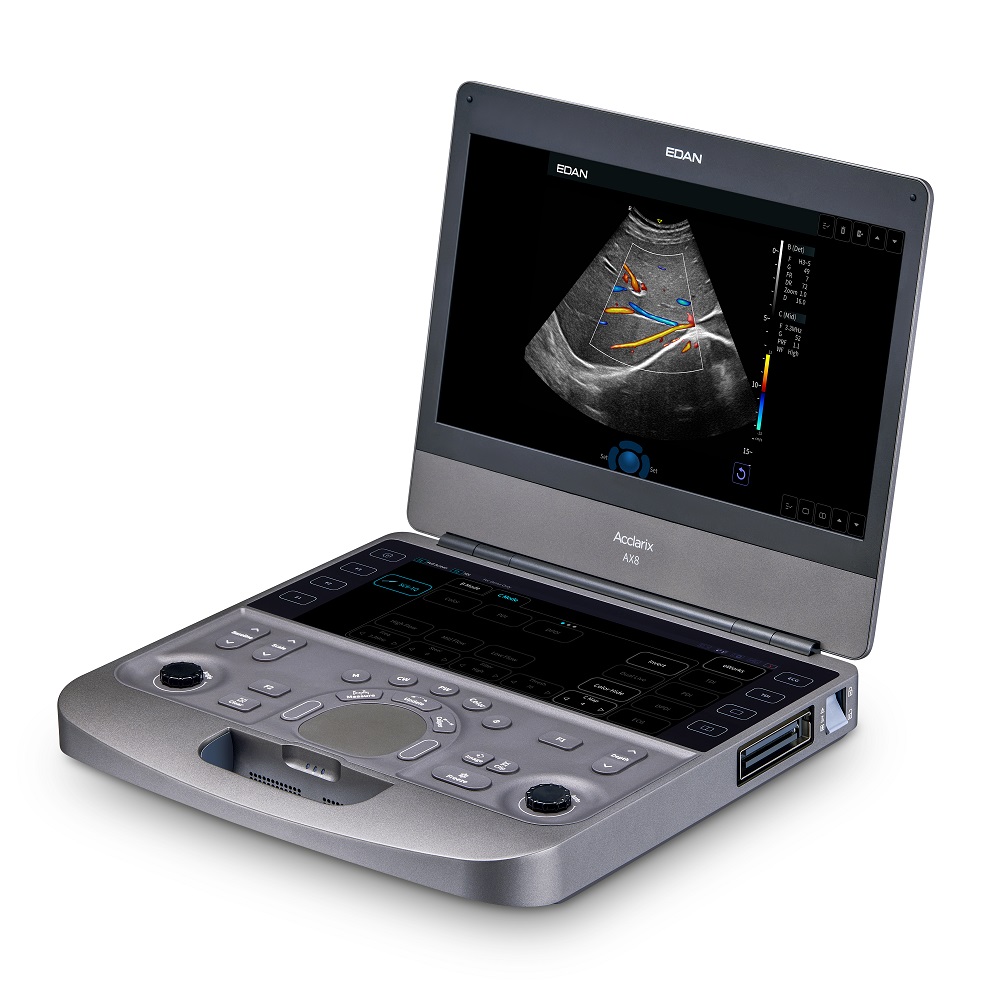 Ultrasonografy mobilne przyłóżkowe EDAN Acclarix AX8