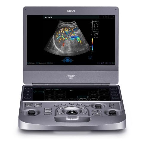 Ultrasonografy mobilne przyłóżkowe EDAN Acclarix AX9