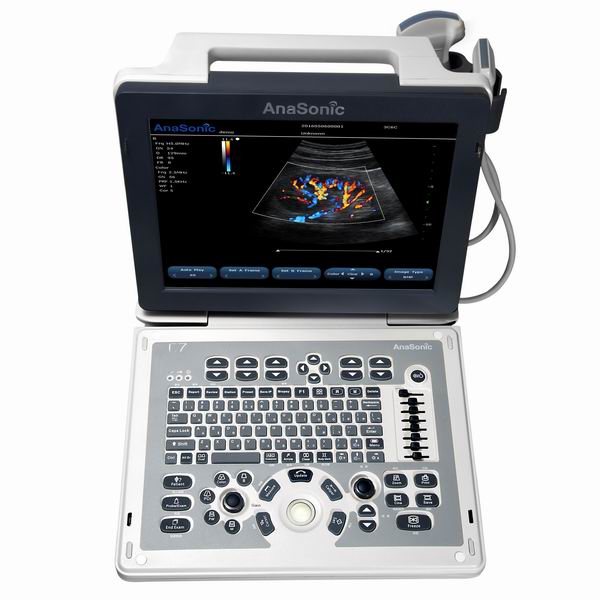 Ultrasonografy mobilne przyłóżkowe Anasonic C7