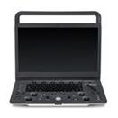 Ultrasonografy mobilne przyłóżkowe SonoScape E2