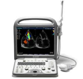 Ultrasonografy mobilne przyłóżkowe SonoScape S8 / S8exp
