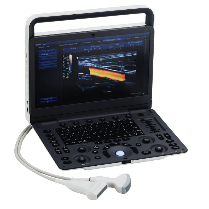 Ultrasonografy mobilne przyłóżkowe Zimmer SonidoSmart Pro