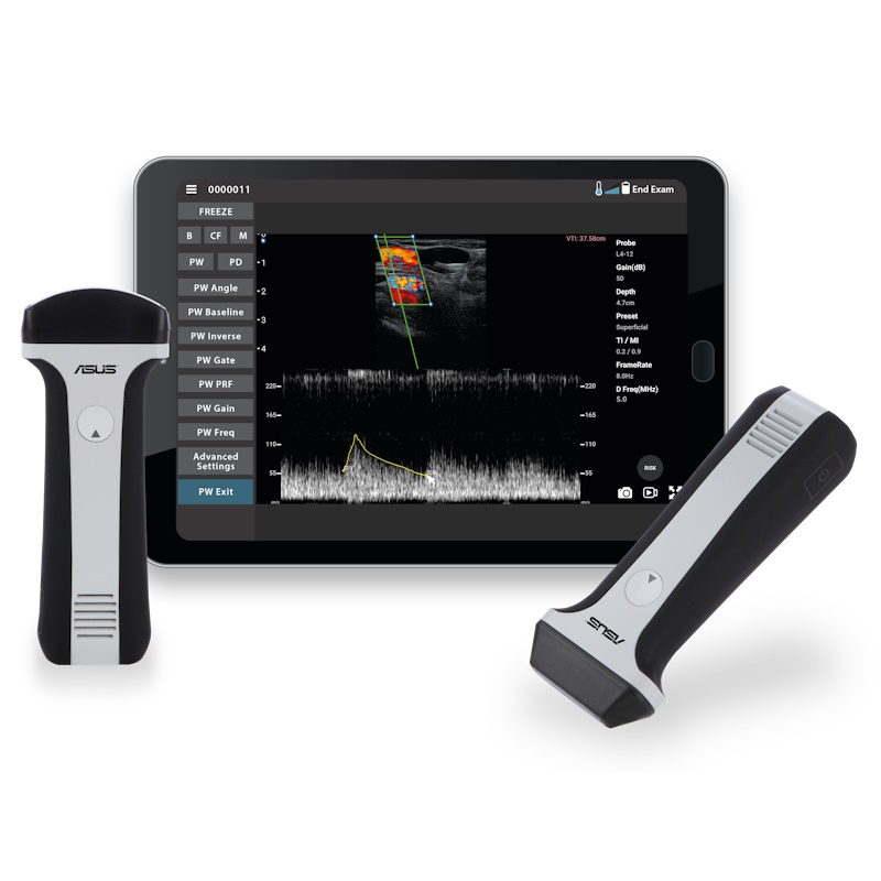 Ultrasonografy mobilne ręczne weterynaryjne ASUS LU700C Vet