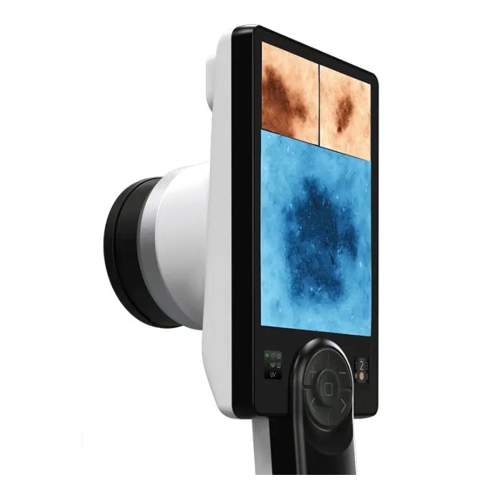 Videodermatoskopy CANFIELD D2