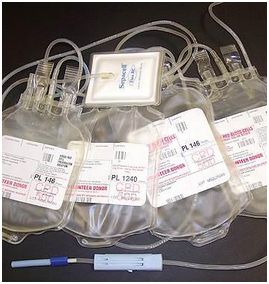 Zestaw do zlewania płytek B/D Zestaw do zlewania płytek