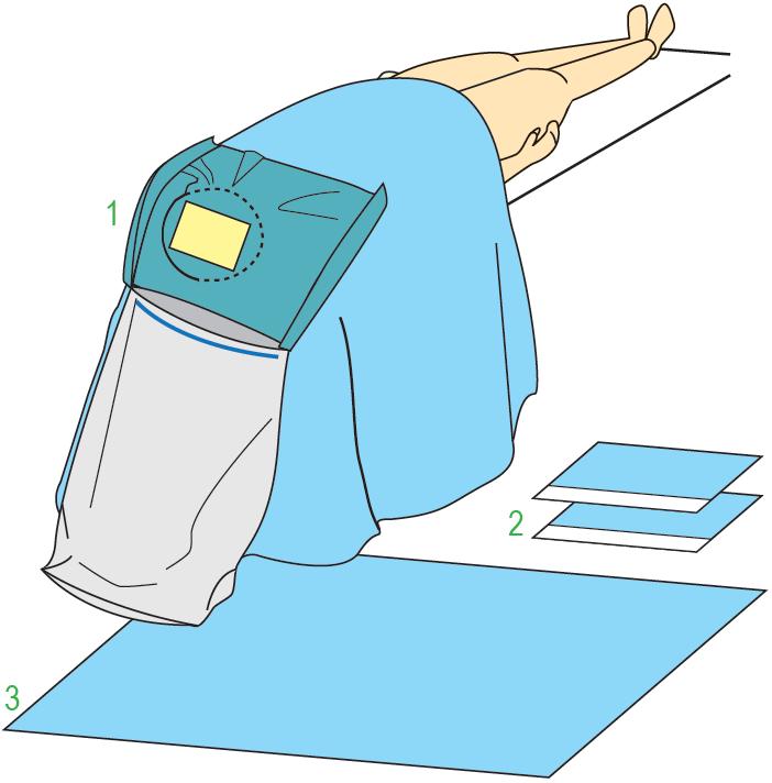 Zestawy do neurochirurgii – obłożenia pola operacyjnego JKT/MOLNLYCKE Zestaw do zabiegów neurochirurgicznych I 380157