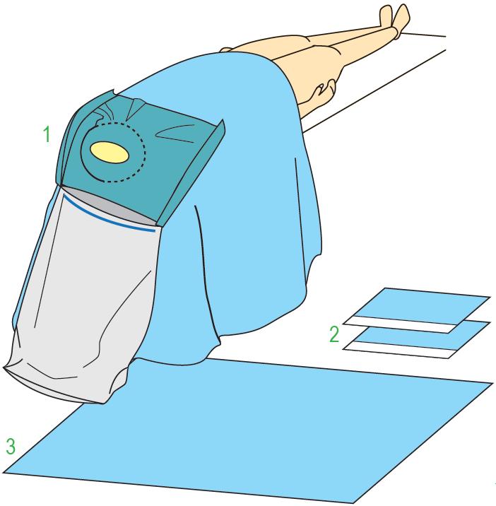 Zestawy do neurochirurgii – obłożenia pola operacyjnego JKT/MOLNLYCKE Zestaw do zabiegów neurochirurgicznych IV 380545