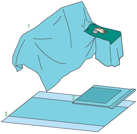 Zestawy do ortopedii – obłożenia pola operacyjnego BARRIER/MOLNLYCKE Zestaw do operacji na kończynie górnej III 60306