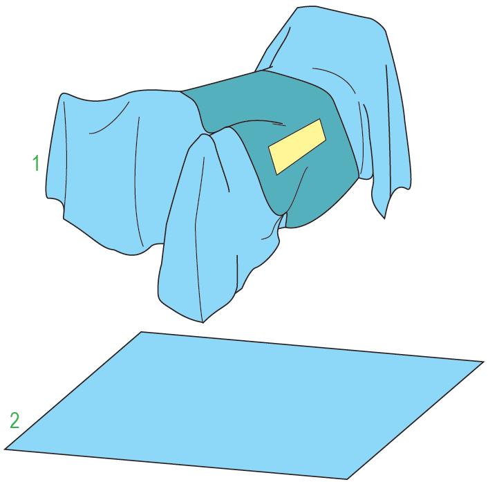 Zestawy do ortopedii – obłożenia pola operacyjnego JKT/MOLNLYCKE Zestaw do operacji stawu biodrowego IX (DHS) 380537