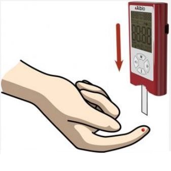 Analizatory (alkometry) alkoholu z krwi pacjenta PAL Albio