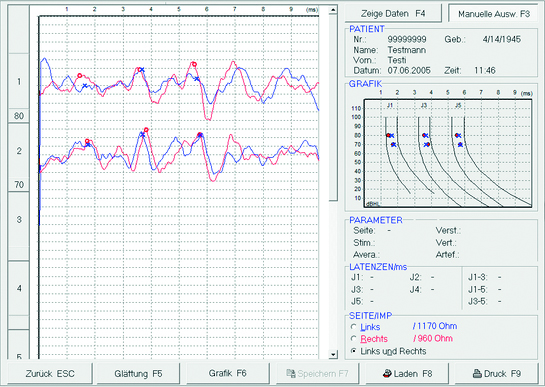 Aparaty do diagnostyki słuchu - otoemisja akustyczna Homoth Medizinelektronik ABR BERA 4000