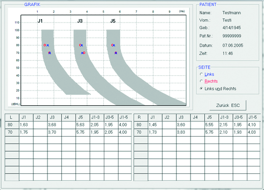 Aparaty do diagnostyki słuchu - otoemisja akustyczna Homoth Medizinelektronik ABR BERA 4000