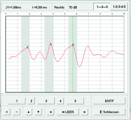 Aparaty do diagnostyki słuchu - otoemisja akustyczna Homoth Medizinelektronik ABR BERA 4000