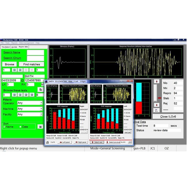 Aparaty do diagnostyki słuchu - otoemisja akustyczna OTODYNAMICS Ltd Echoport ILO 288