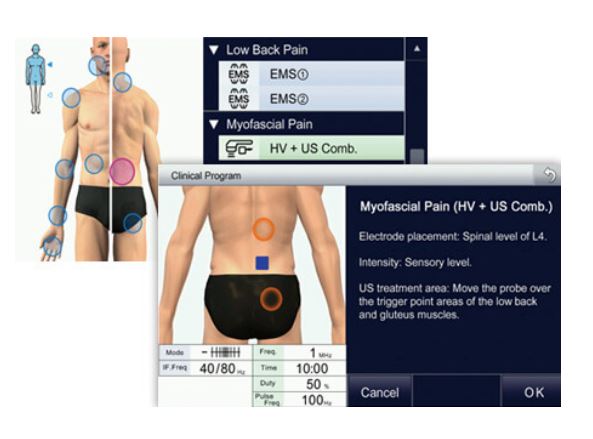 Aparaty do elektroterapii ITO Physiotherapy & Rehabilitation EU-921