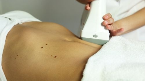 Aparaty do kosmetologii – Combo LestheZone LipoRadioLogie™ VINCI