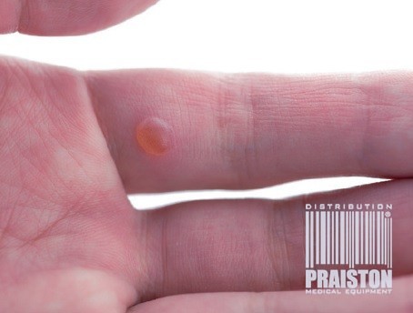 Aparaty do kriochirurgii Freezpen CL-FP-35