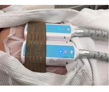 Aparaty do kriolipolizy (do usuwania cellulitu) B/D CRYO-SCULPT EMS