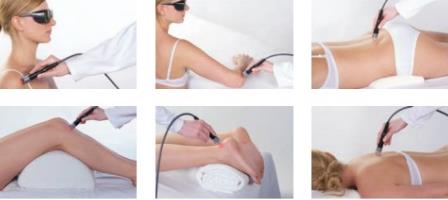 Aparaty do laseroterapii BTL BTL-6000 HIL 7W