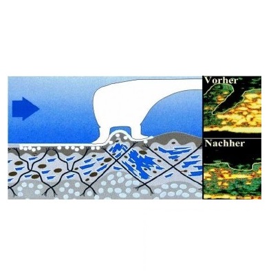 Aparaty do masażu Dr. Frenkel BeautyVital3000