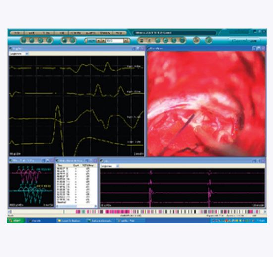 Aparaty do neurostymulacji i neuromonitoringu śródoperacyjnego Cadwell Cascade