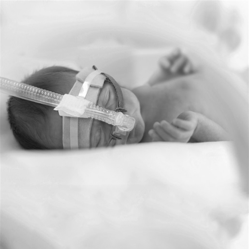 Aparaty do nieinwazyjnej wentylacji Inspiration Healthcare Inspire rPAP