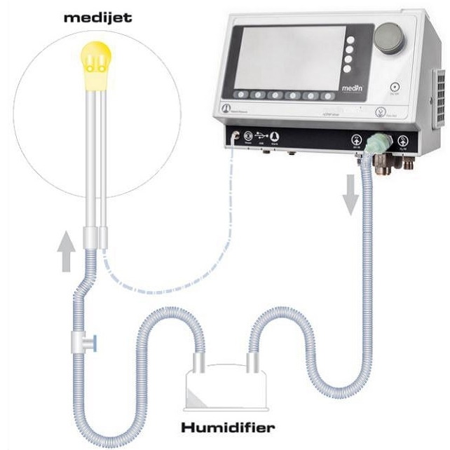Aparaty do nieinwazyjnej wentylacji MEDIN Medical Innovations GmbH medinCNO mini