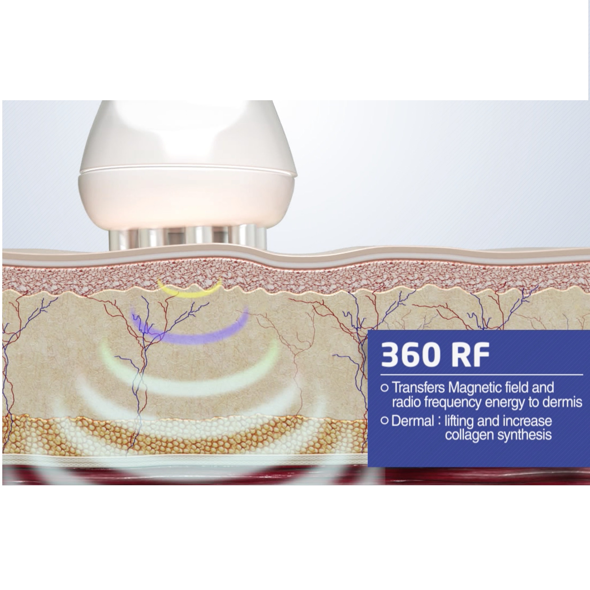 Aparaty do radiofrekwencji Bluvance 360 MULTIPOLAR RF