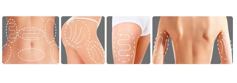 Aparaty do terapii falami uderzeniowymi B/D Fala uderzeniowa elektromagnetyczna