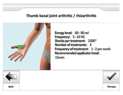 Aparaty do terapii falami uderzeniowymi ITO Physiotherapy & Rehabilitation RSK-600