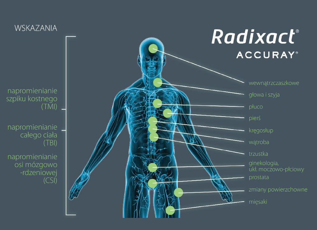 Aparaty do tomoterapii Accuray Radixact