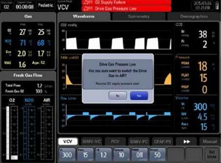 Aparaty do znieczulenia ogólnego MINDRAY WATO EX-65