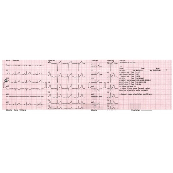 Aparaty EKG - Elektrokardiografy CONTEC ECG 600G