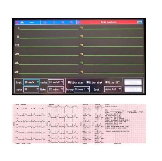 Aparaty EKG - Elektrokardiografy CONTEC ECG 600G