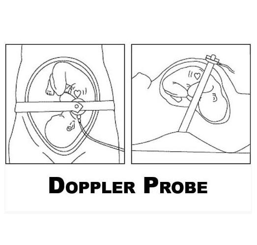 Aparaty KTG - kardiotokografy Bionet FC 700