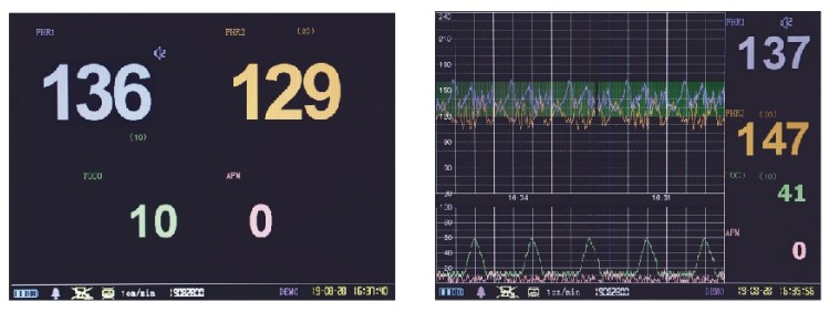 Aparaty KTG - kardiotokografy Jumper JPD-300Pb
