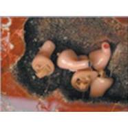 Aparaty słuchowe VIDEOMED Agate