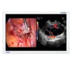 Artroskopy B/D zestaw