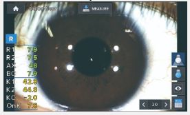 Autorefraktometry (autokeratorefraktometry) HUVITZ HRK-1