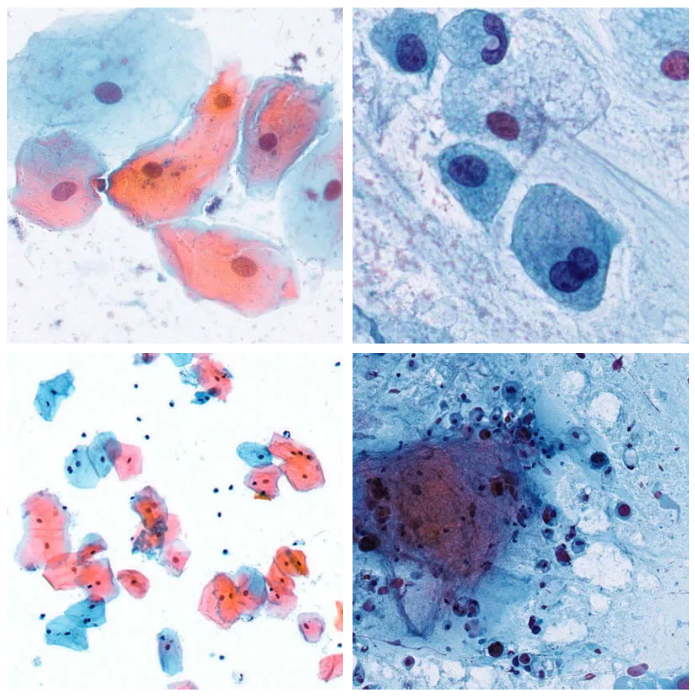 Barwiarki ELITechGroup Aerospray Cytology