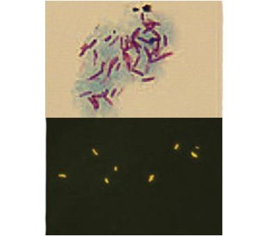 Barwiarki ELITechGroup Aerospray® TB / seria 2