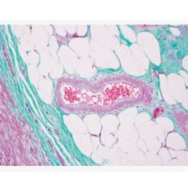 Barwniki histopatologiczne - do histologii LEICA Gomori's Trichome