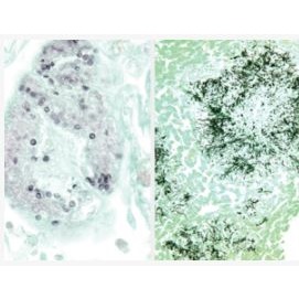 Barwniki histopatologiczne - do histologii LEICA Modified GMS Silver Special