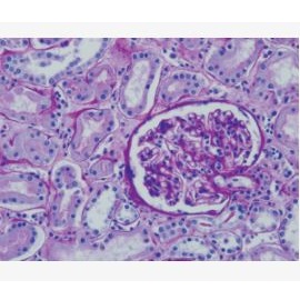 Barwniki histopatologiczne - do histologii LEICA Periodic Acid and Schiff